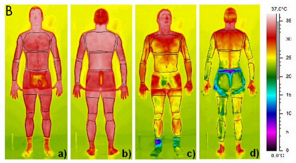 Cryo Sauna Image